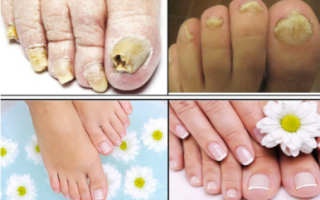 Urgent Fungus Destroyer Benefits